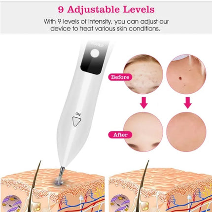 Skin Tag Repair Kit Portable Beauty Equipment Multi-Level With Home Usage USB Charging LCD Level Adjustable 6 Replaceable Needles